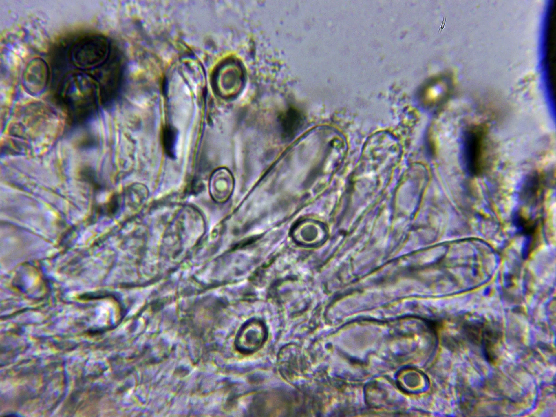 Microscopía de Leucoagaricus cinereolilacinus - 10 - Queilocistidios
